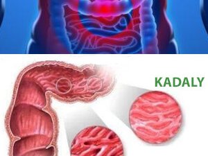 PROKTIT: SEBÄPLERI, ALAMATLARY, BEJERGI ÇÄRELERI