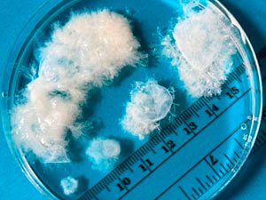 10 HEPDÄ ÇENLI GÖWRELILIK – SURATLARDA 