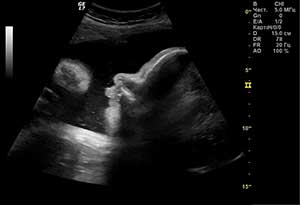 moya istoriya beremennosti 5