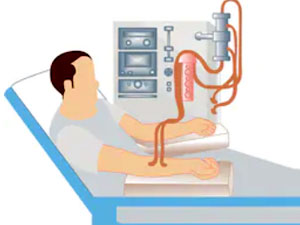 covid 19 bowrek dializ