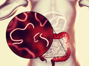 gurcugy nahili bejerip bolyar