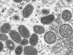 maymyn mama yayramagy