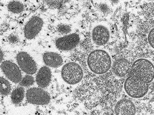 maymyn mamasy global yagday