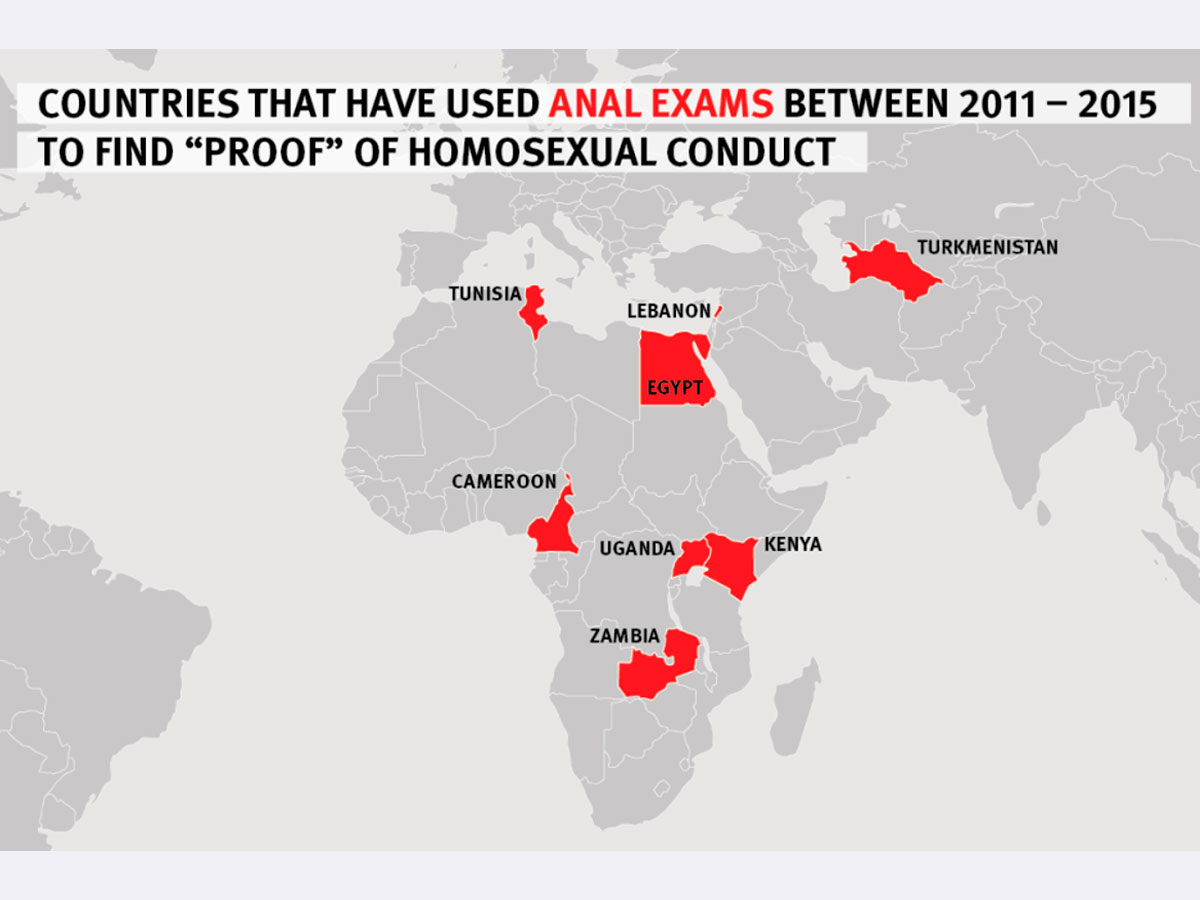 mejbury anal barlaglar