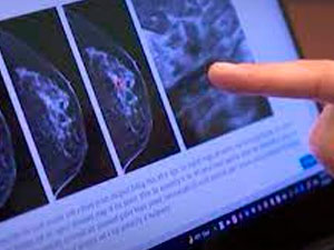 rak keselinin onuni almak