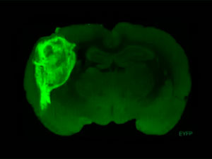 psihiatrik bozulmalary owrenmek