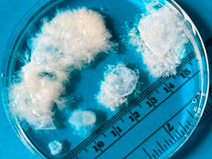 10 hepda cenli gowrelilik