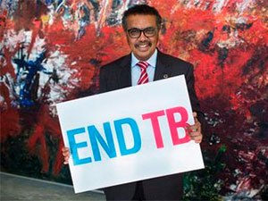 bsgg incekesele garsy taze waksina