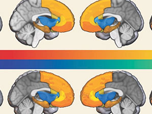 garyplyk we caga beynisi