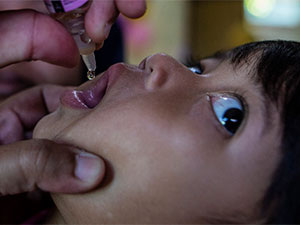 immunizasiyany unsden dusurip bilmeris