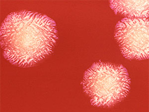 endometriozyn doreysi