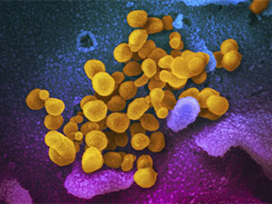 covid in bejergisinin gozlegine cykylar