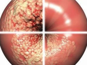 yatgynyn boyunjygynyn displaziyasy