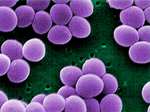 antibiotik durnuklylygy barada