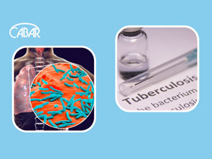 gyrgyzystan incekesel hadysalary