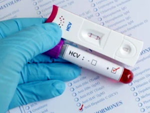 hcv test