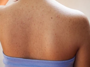 endamda doreyan duwurtikler