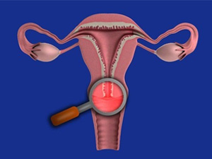 eroziya onelgesizlige getirip bilyarmi
